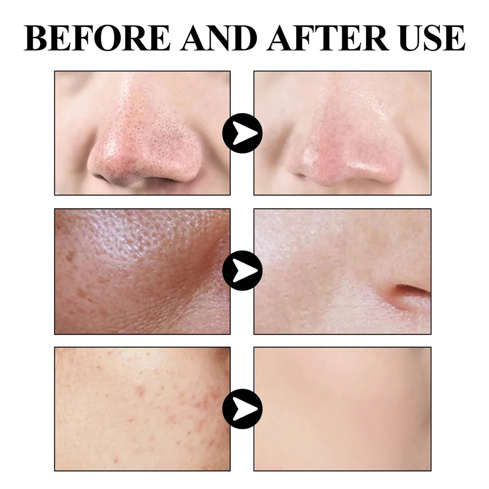 Blackhead Removing Solid Mud Facial Cleansing Mask