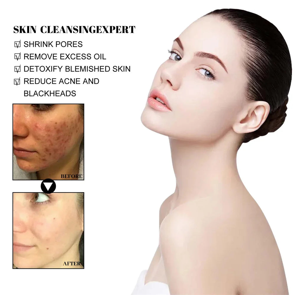 Blackhead Removing Solid Mud Facial Cleansing Mask