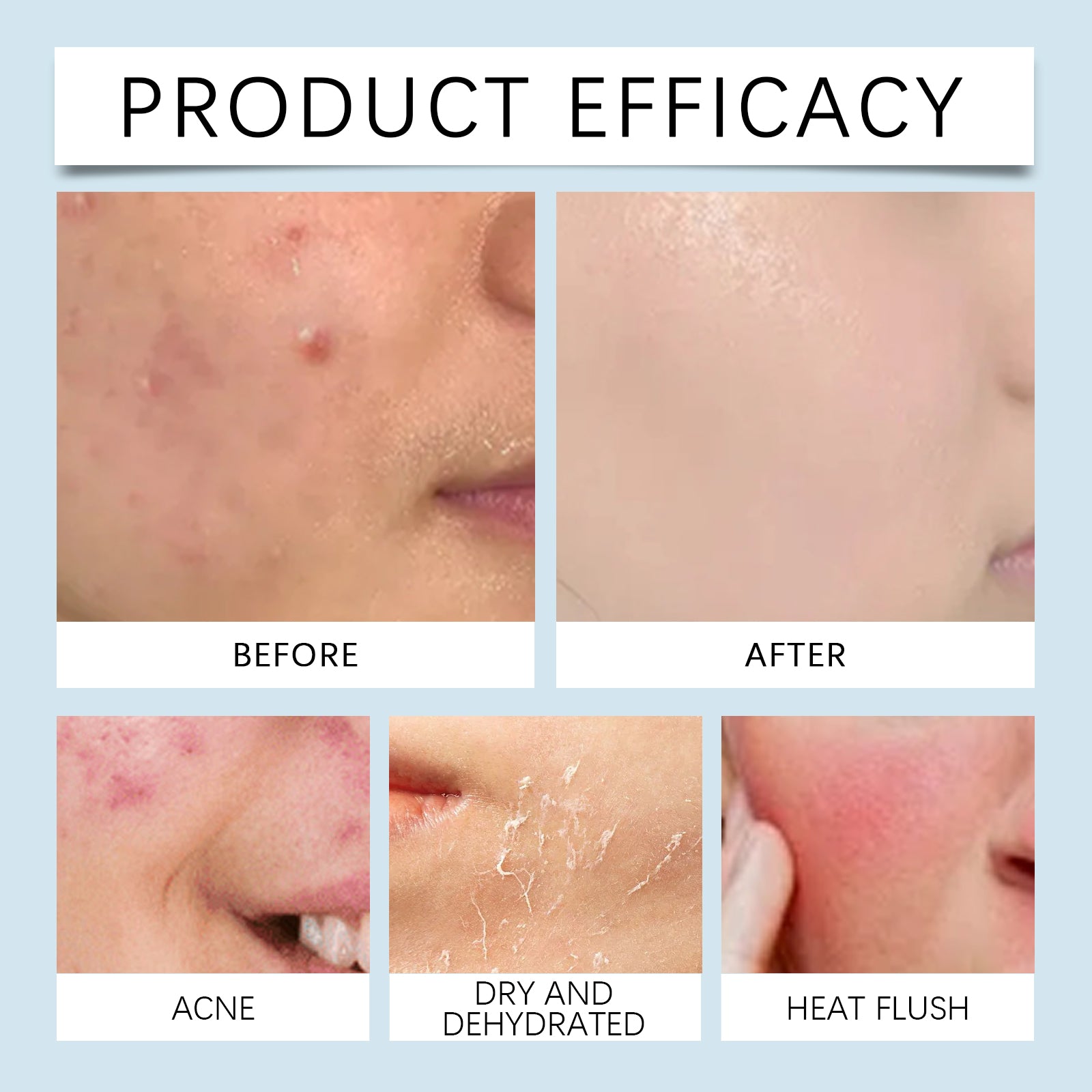 Hyaluronic Acid Face Serum for Hydrating Skin